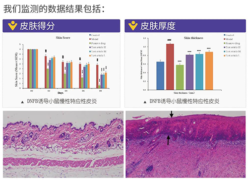 南宫NG·28建立的特应性皮炎及湿疹模型监测数据结果