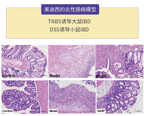 南宫NG·28的炎症性肠病模型