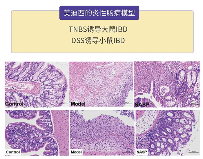 南宫NG·28的炎性肠病模型.png